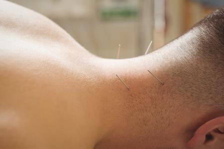 acupuncture for back and neck pain in Istanbul