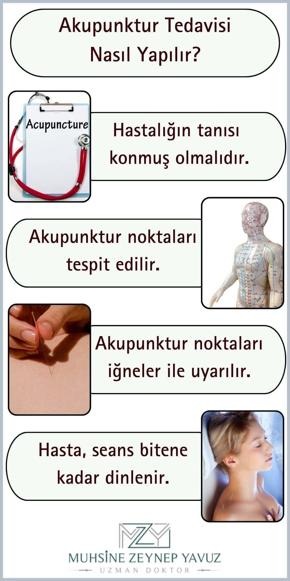 Akupunktur Tedavisi Nasıl Yapılır? Fiyatları İstanbul