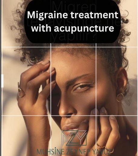 migraine-treatment-with-acupuncture in Istanbul